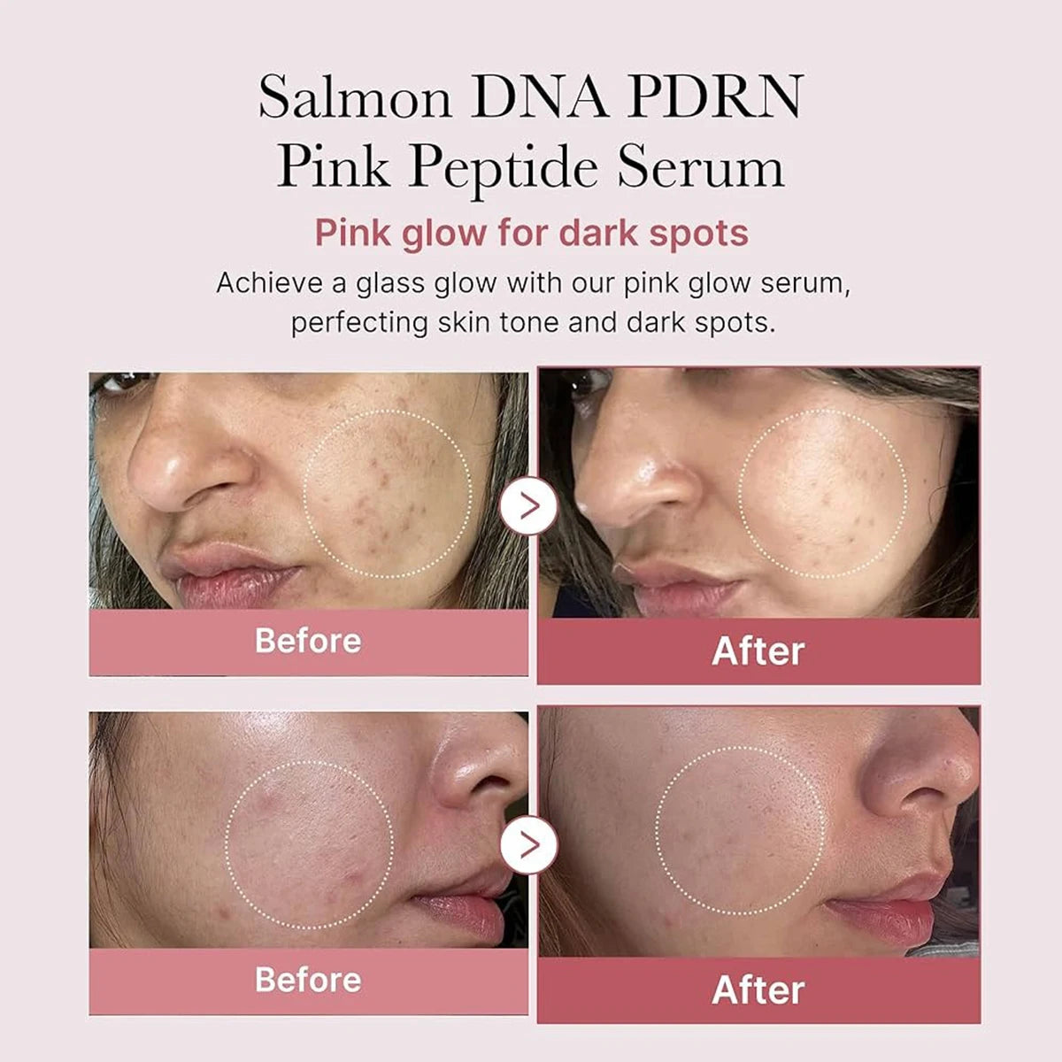 Medicube Salmon DNA PDRN Peptide Serum For Firming Skin